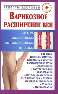 Варикозное расширение вен.